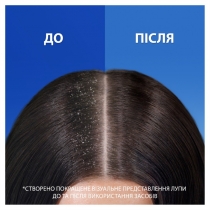 Шампунь проти лупи Head & Shoulders Основний догляд 900 мл